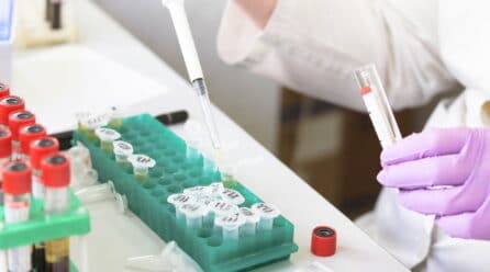 Alerta alimentaria de la Junta de Andalucía por listeria en Málaga